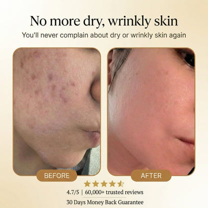 NESLEMY Organic Tallow Honey Balm to Help Erase Fine Lines, Wrinkles, and Age Spots